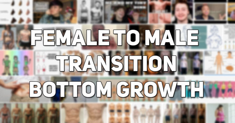Female to Male Transition Bottom Growth - Female to Male Bottom Growth  